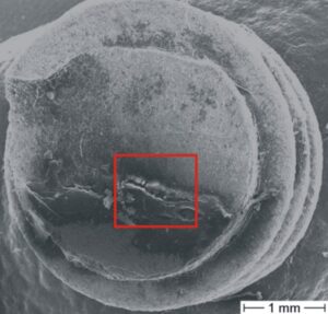 Microscopic image of a fracture surface on a dental implant