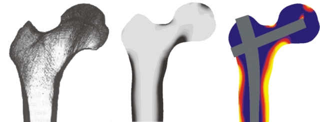 density distribution in a bone