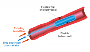 FSI - Fluid Structure Interaction