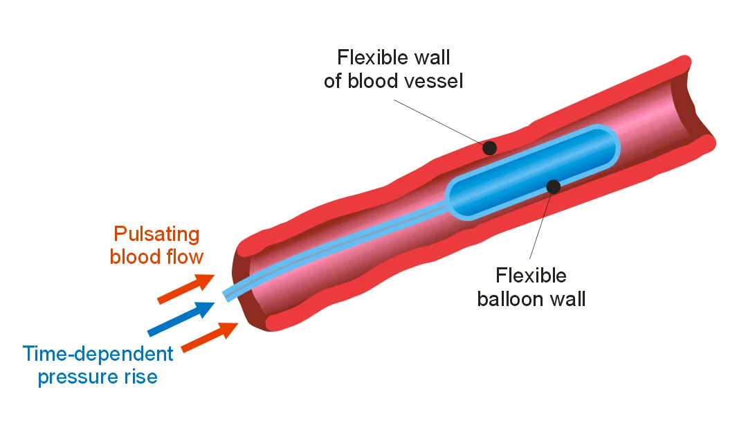 FSI - Fluid Structure Interaction